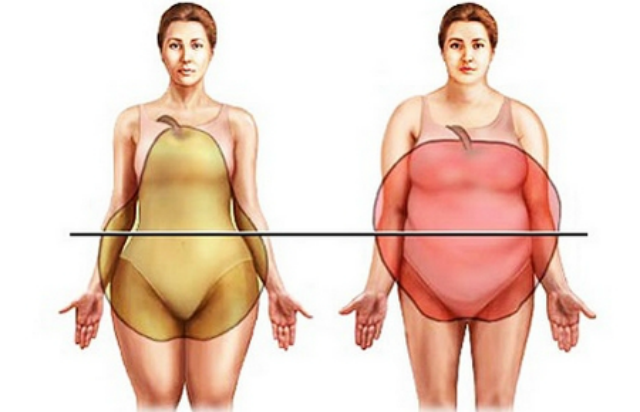 Tipos de obesidade