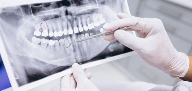 planos odontológicos 