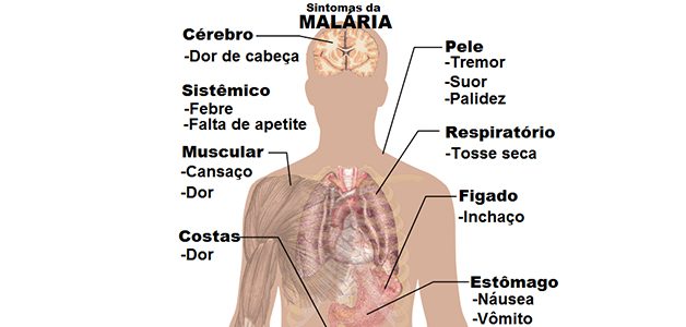sintomas da malária